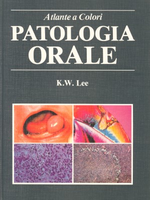 Patologia orale - Atlante a colori